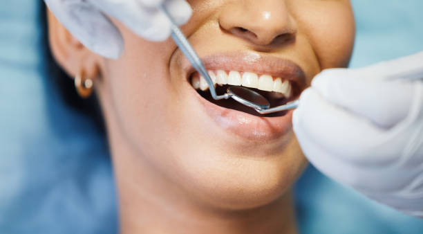 Best Orthodontic Emergency Dentist in El Sobrante, CA
