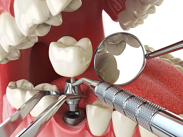 Best Emergency Dental Services for Seniors in El Sobrante, CA